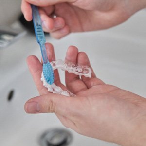 Patient using toothbrush to clean clear aligner