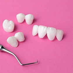 There are two main types of dental bridges