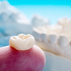 Porcelain crown resting on person’s fingertip