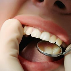 Closeup of dental exam