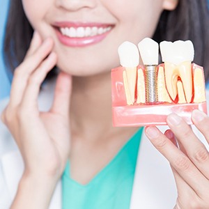 A dentist holding a fake dental implant