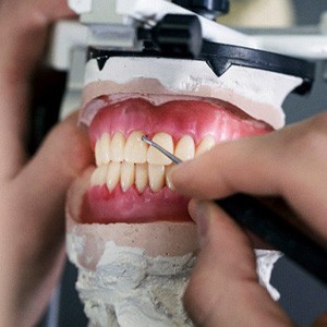 a technician working on a pair of dentures