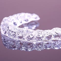 Invisalign alignment tray