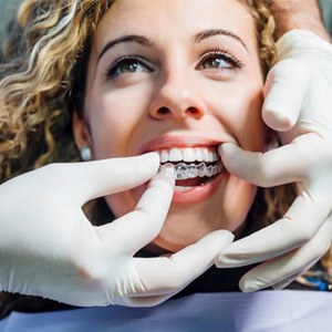a patient receiving her new Invisalign aligners