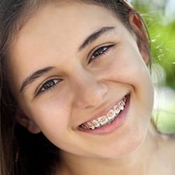 Smiling young girl with bracket and wire braces