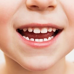 Closeup of child's healthy smile after pediatric dentistry