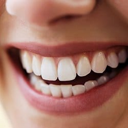 Closeup of healthy teeth and gums after dental implant tooth replacement