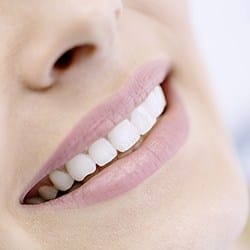 Closeup of whole healthy smile after inlay and onlay restoration