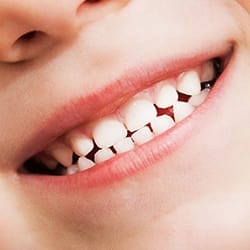 Closeup of child's healthy smile