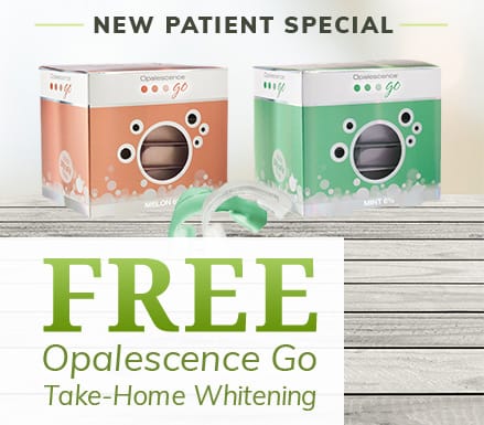 Opalescensce whitening kits