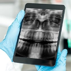 Digital x-rays on tablet computer