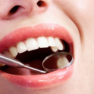 Dental mirror reflecting woman’s back tooth