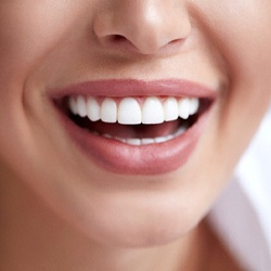 Close-up of woman’s smile after teeth whitening in Fairfax, VA